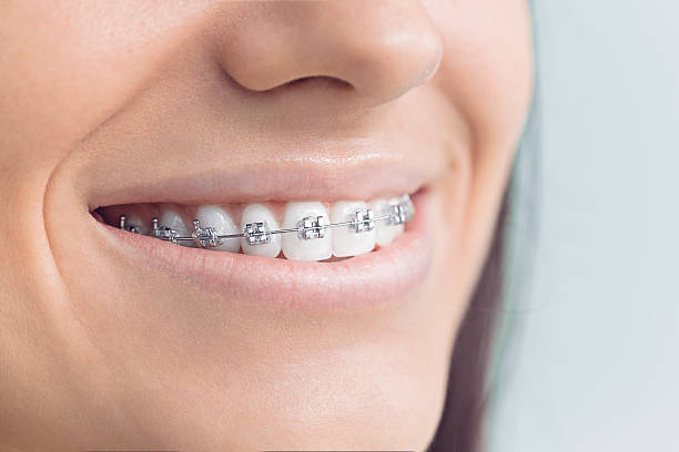 Best Veneers and Lumineers  in Ata, OK